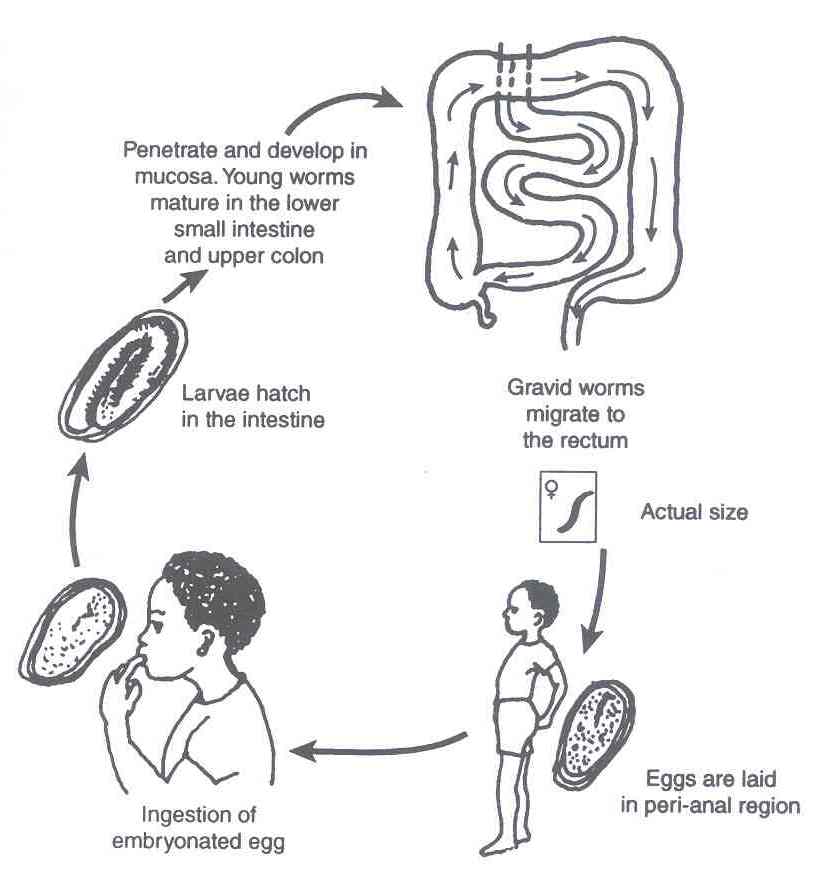 Pinworm.jpg