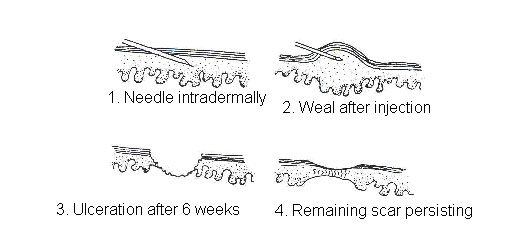 Needleposition2.jpg
