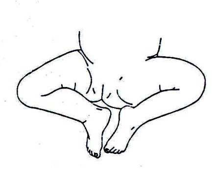 Deformedlegs2.jpg