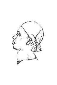 Goitre2.jpg
