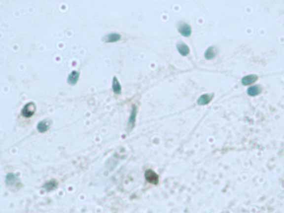 File:Sperm3.jpg