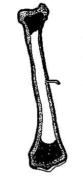 Section through long bone.JPG