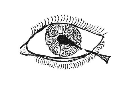 Peforatingeye.jpg
