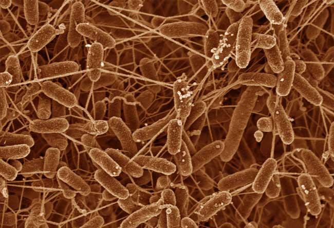 File:Metal-reducing bacteria.jpg