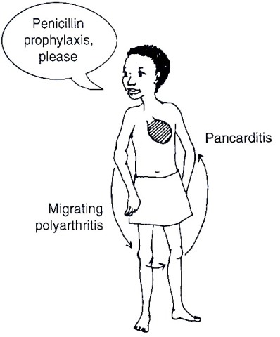 Rheumaticfever.jpg