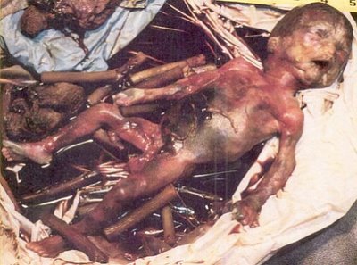 File:7 months.jpg