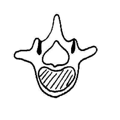 Vertebra unlabelled.JPG